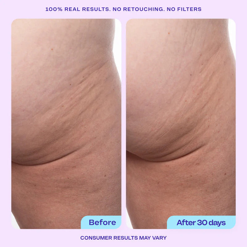 ElleLift Firming Butt & Thigh Cream